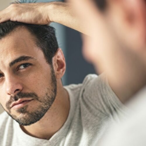 Hair Hair Transplant