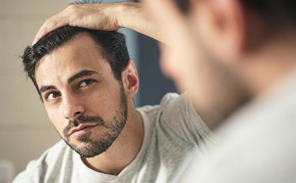 Hair Hair Transplant