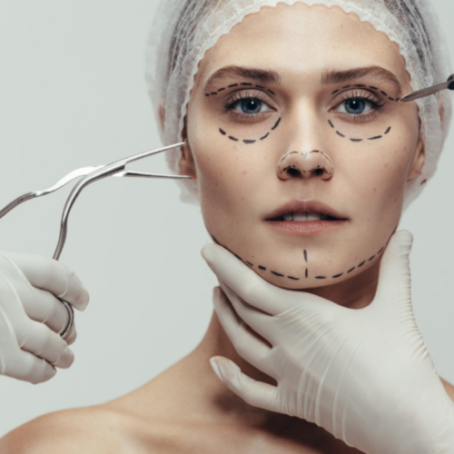 How much does it cost to undergo facial feminization surgery?